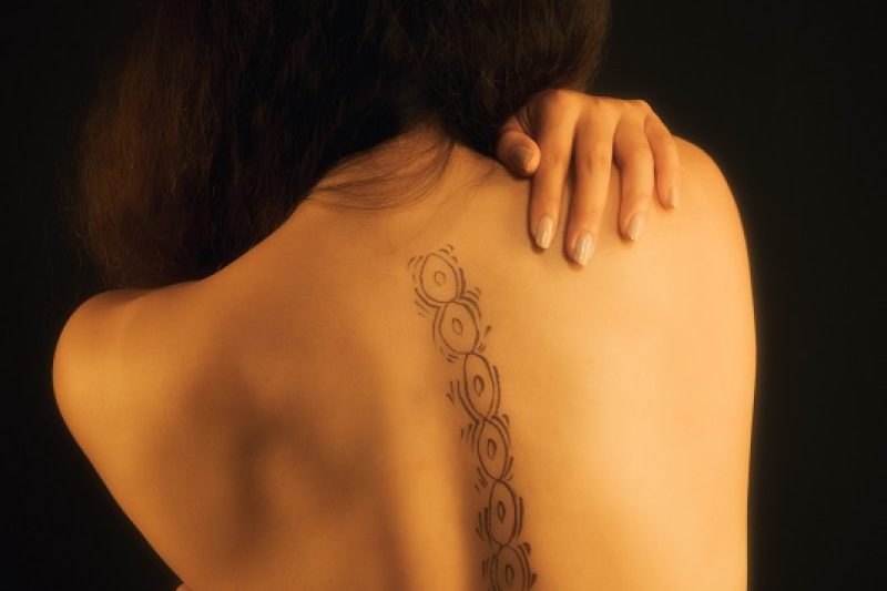 Spinal Disc Problems